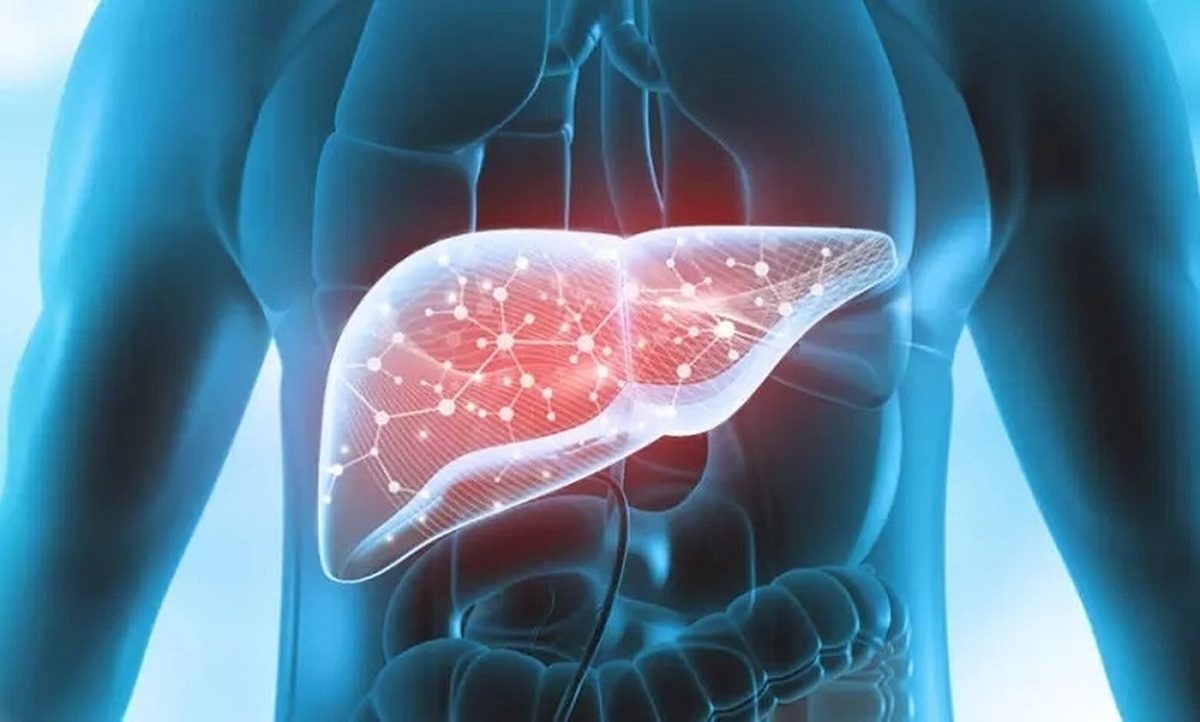 کبد چرب غیرالکلی (NAFLD)؛ خاموش‌ترین بیماری کبدی
